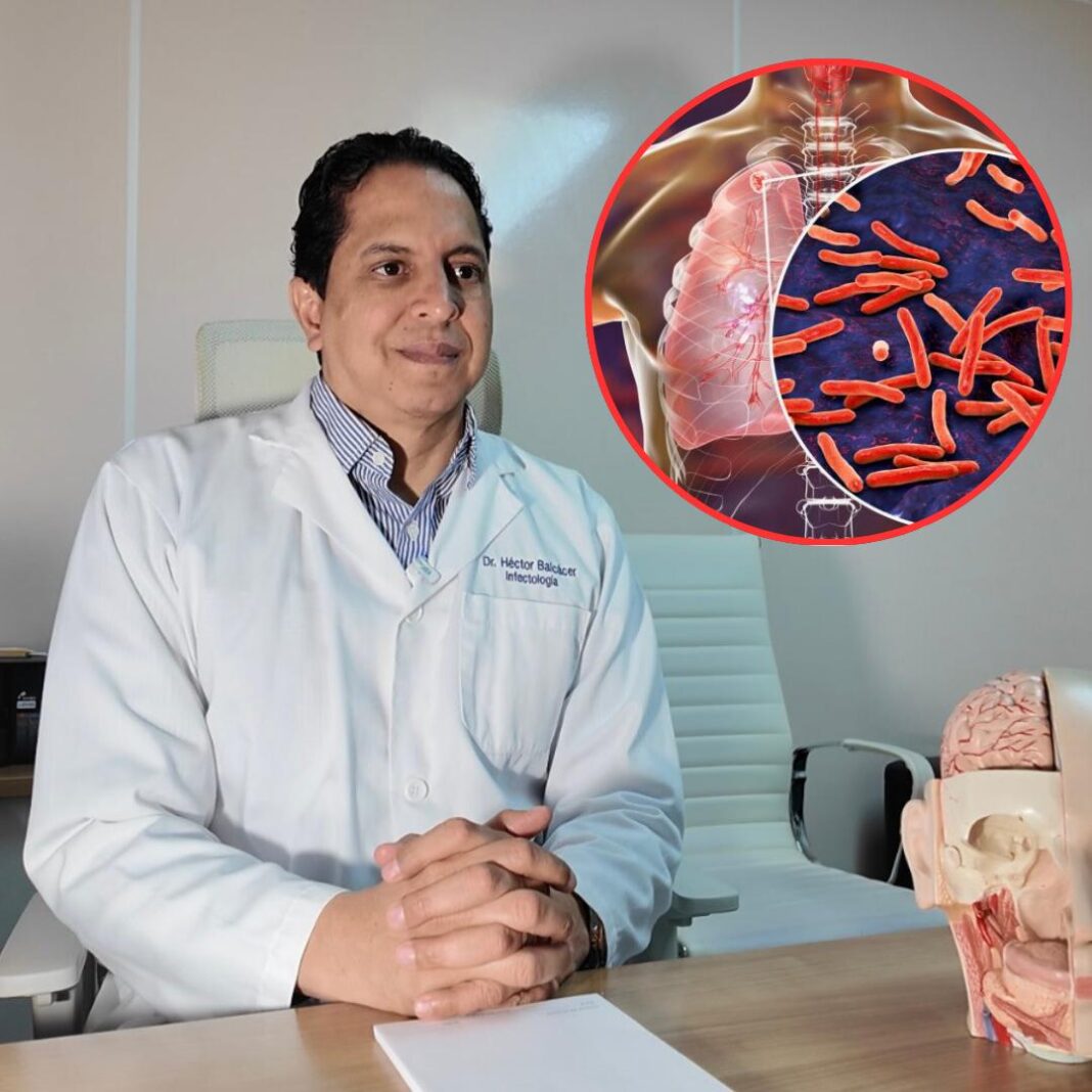 Entre 3,000 y 4,000 casos de tuberculosis se detectan cada año en el país